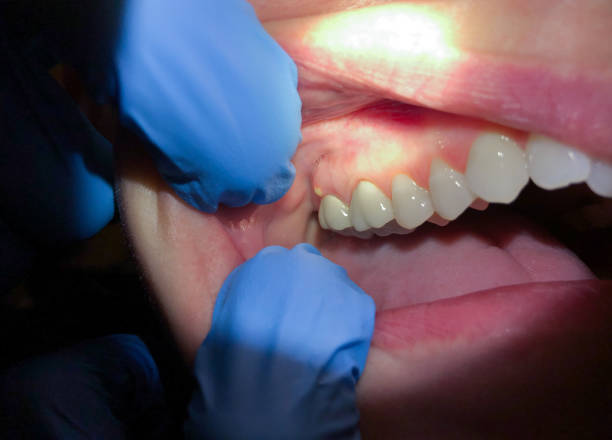 Best Weekend Emergency Dentist in North Lakeville, MA